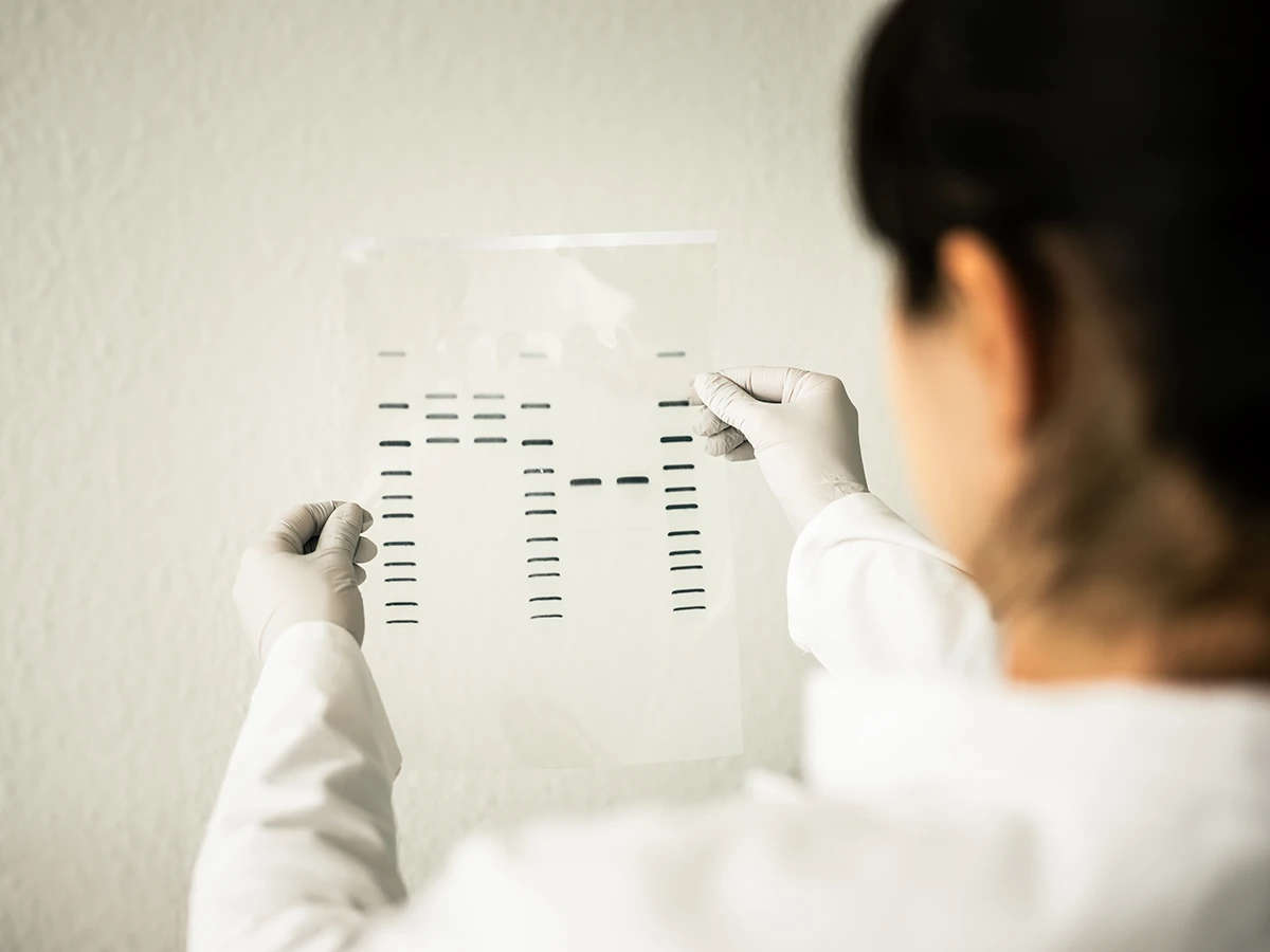 _NBR9786 Molecular size markers